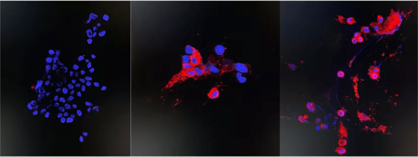 仅4天，香港大学微生物系团队成功分离奥密克戎毒株