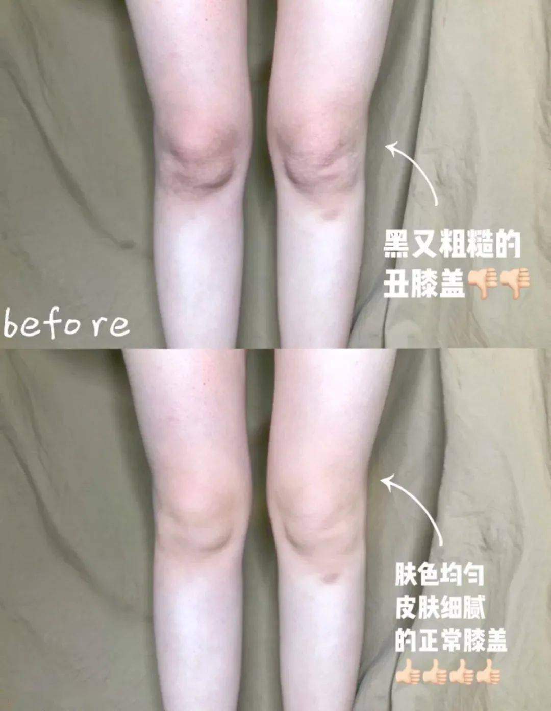 草本植物脚跟开裂、老茧、死皮……又疼又丑！用它一抹，双脚嫩滑，实测惊呆了！