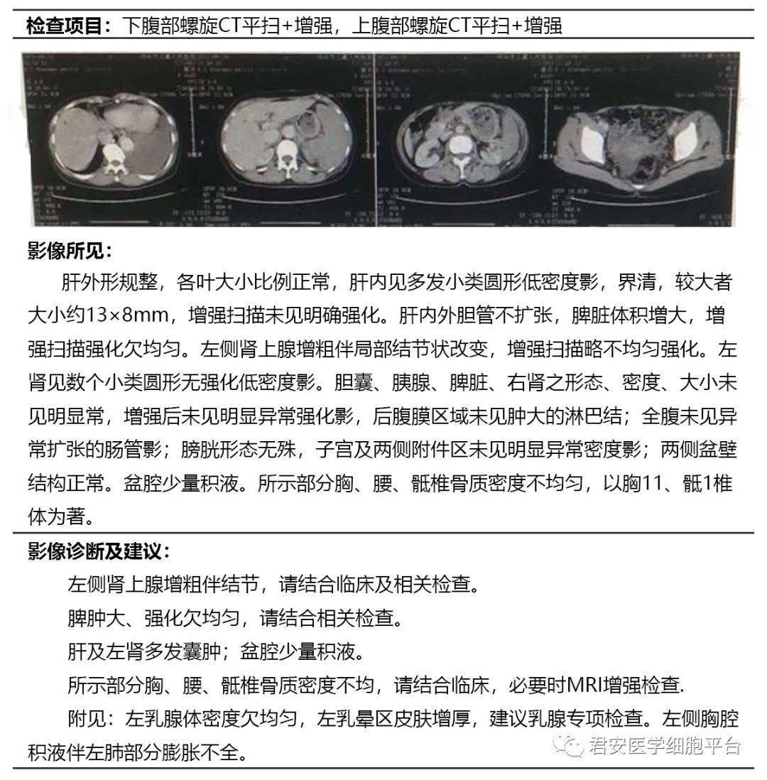 骨髓细胞学检查报告单图片