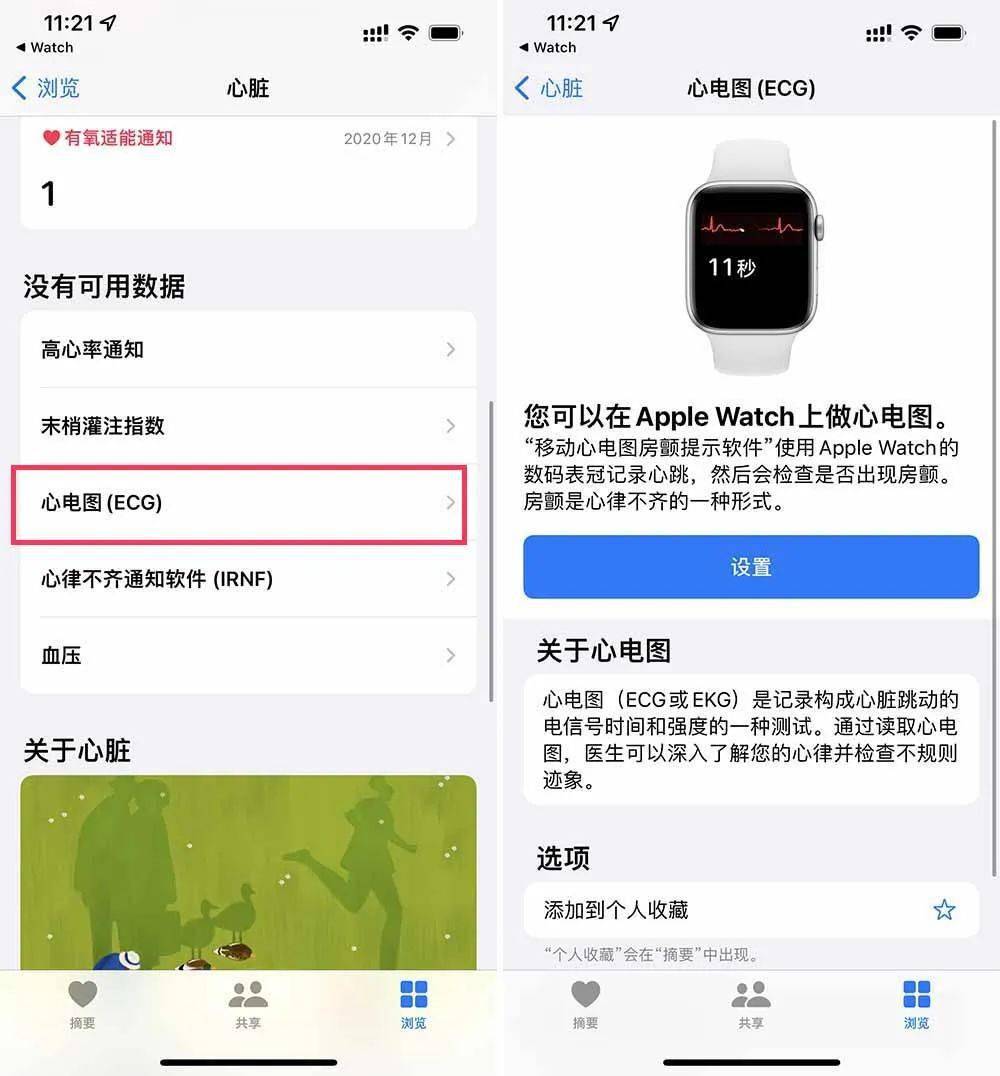 移动|等了 3 年，国行版 Apple Watch 心电图功能终于来了！