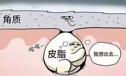 闭口是什么啊 2954f343e24d4c65b60bcf17d7fd6cee.jpeg