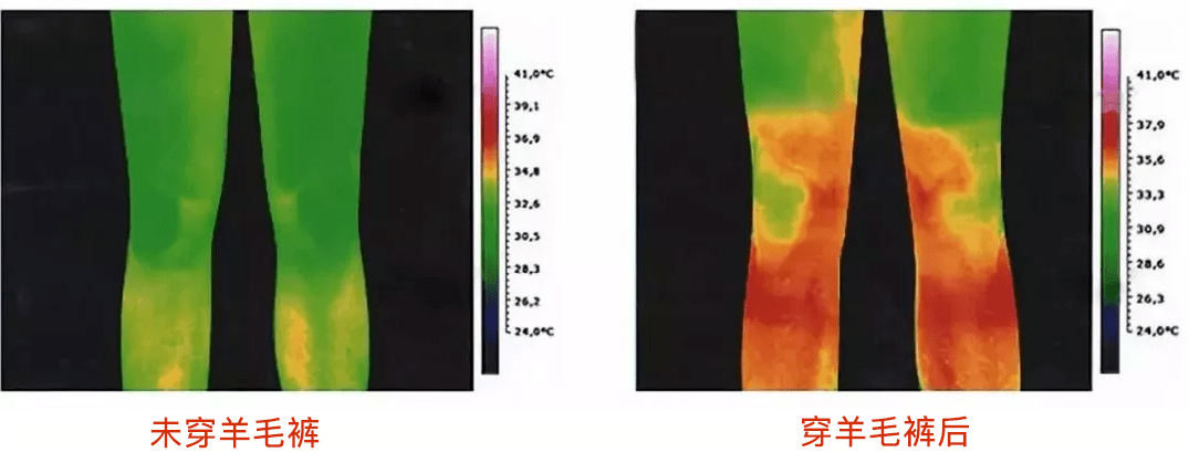 身体|秋裤界的“劳斯莱斯”！绵羊毛自发热，一件=暖腹带+护膝，37℃恒温保暖，穿上秒变大长腿！