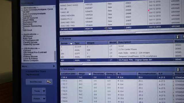 冠脉cta检查完后最终拿到的后处理片子是怎么来的吗来吧看看