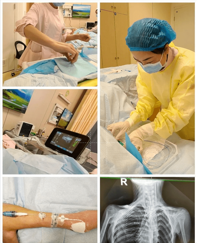 b超定位下的儿童picc置管术,是太原市妇幼保健院picc置管护理技术的