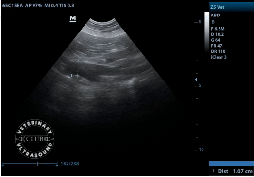 超声检查中十二指肠乳头主动脉门静脉的正常大小是多少2张表带你个个
