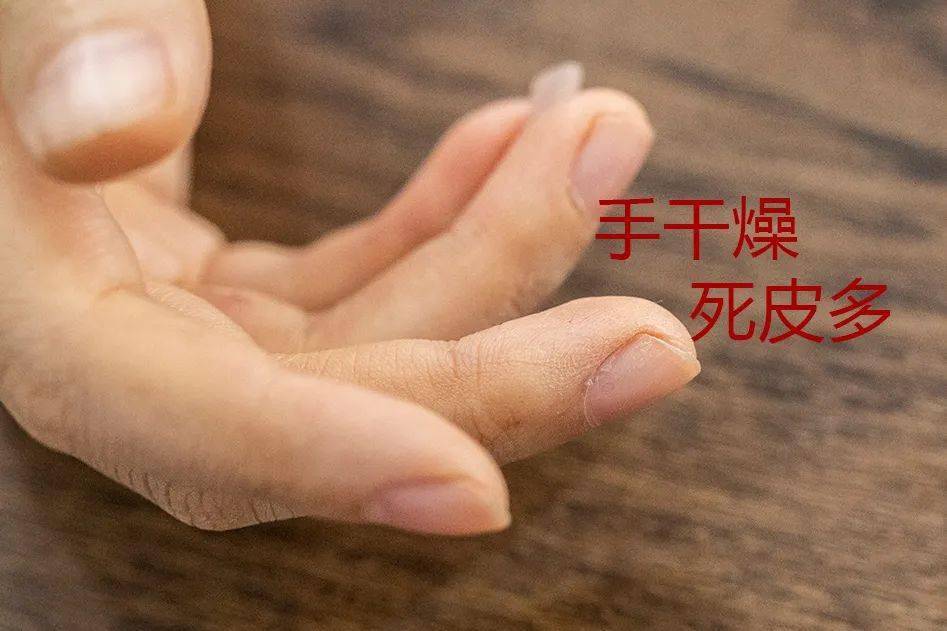 我国维E乳“不好用”？北京协和医院怒了：不是我们出的