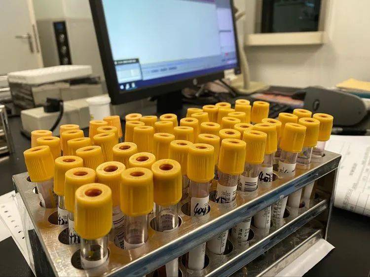 药物小分子打交道的,采用电化学方法对乙肝,丙肝,梅毒,艾滋病,甲状腺