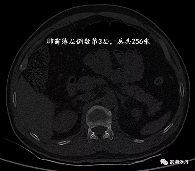 静脉|影像阅片，千万不能“掐头去尾”