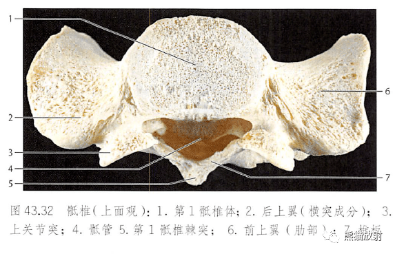 骶椎骶骨(前面观,后面观)尾骨椎间盘主要结构椎体终