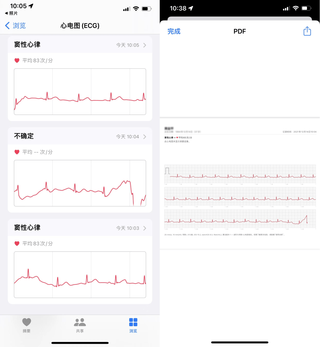 终于来了applewatch的心电图功能好用吗