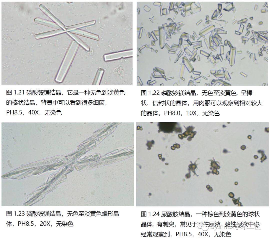 尿液结晶形态汇总_sysrnex_学术_来源
