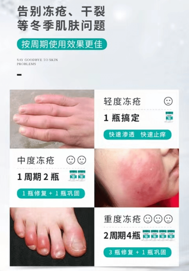 皮肤修护手足开裂 冬季滋养皮肤