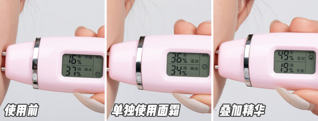 米加多一到冬天就冻成“小红脸儿”，我还有救吗？