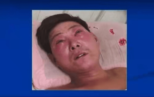 西安出现流行性出血热是鼠疫谣言人传人谣言