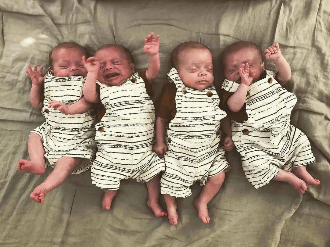全球仅72例！同卵四胞胎一出生就轰动全美，如今长大了竟然..._搜狐网, image size:1080x810