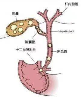 医院资讯守护生命百色市田阳区妇幼保健院成功抢救一位急性梗阻性化脓