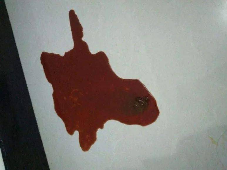 随后猫咪会逐渐表现出精神状态差,不吃东西的情况,偶尔会出现呕吐,流