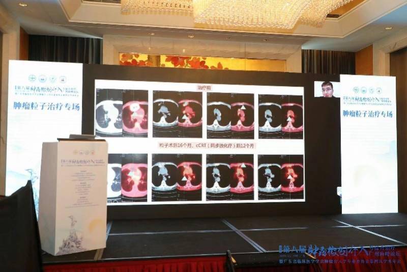 李家平|这个创伤小、靶点准的技术填补传统空白，成为肿瘤治疗生力军