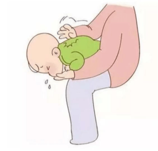 呛奶的程度较重(有面色发紫的表现),应让宝宝俯卧在大人腿上,上身向下