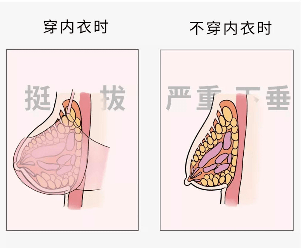 穿胸罩会惯坏你的乳房悬韧带,让它长期处于消极怠工的状态,长而久之