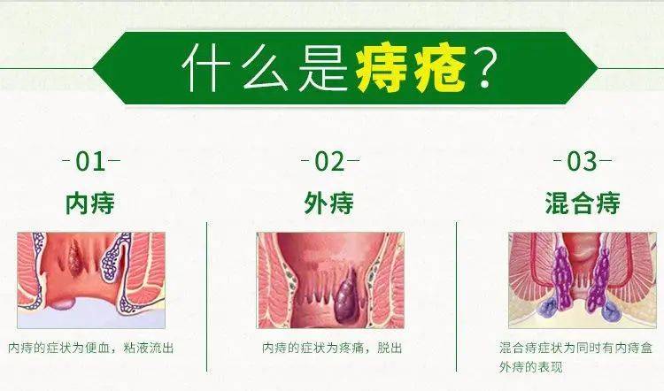 肛门疾病有哪些图片