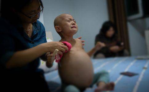 项目推介癌症已成儿童病亡头号死因