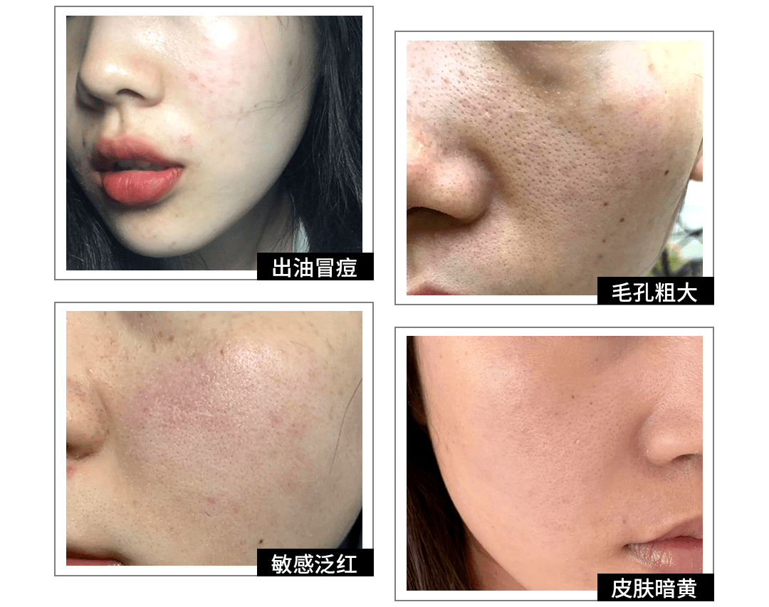 屏障为什么她敷出了从美容院出来的效果？