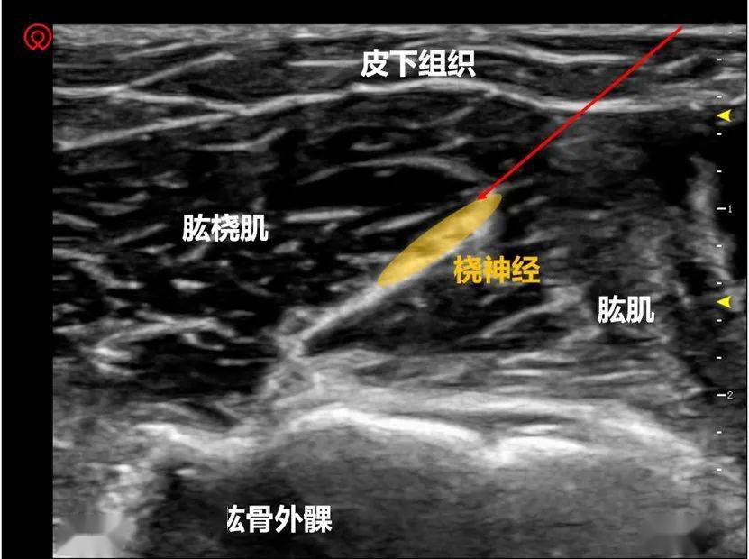 战斗陀螺金属对决