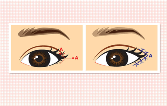 510af03d558946b98dd36e4ba96d5822.png