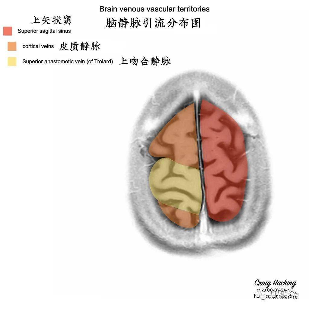 這份高清腦動,靜脈供血分佈圖譜要給滿分!_解剖圖_全網_影像