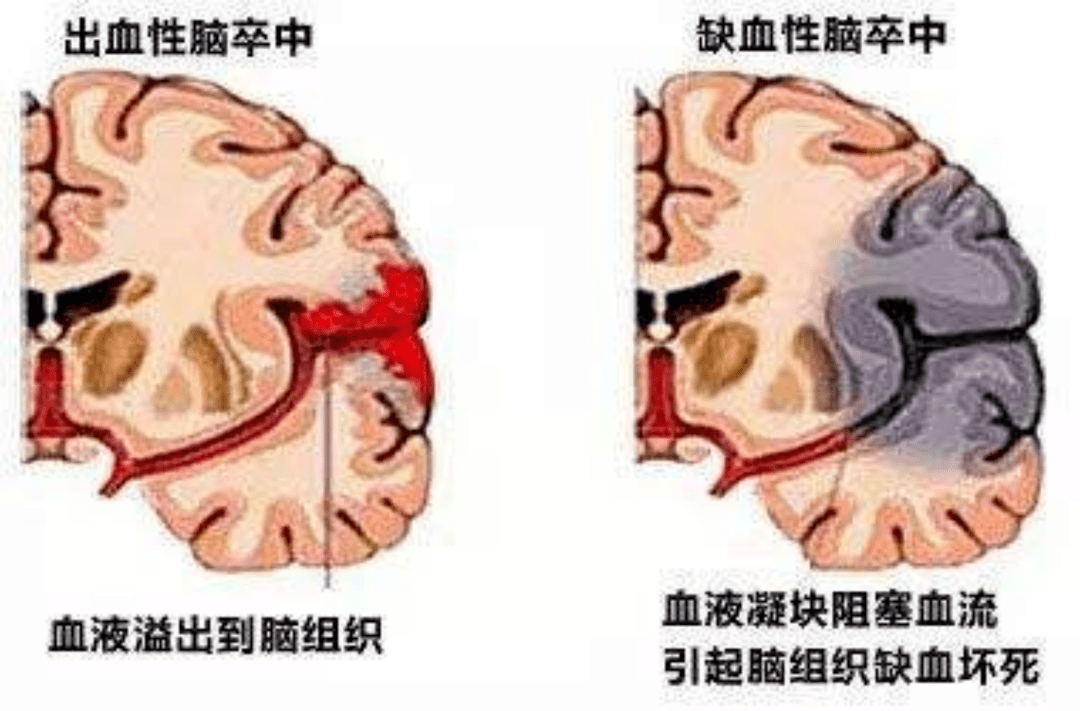 28fc69b5e5f7447f8692be0df1d3605e.png