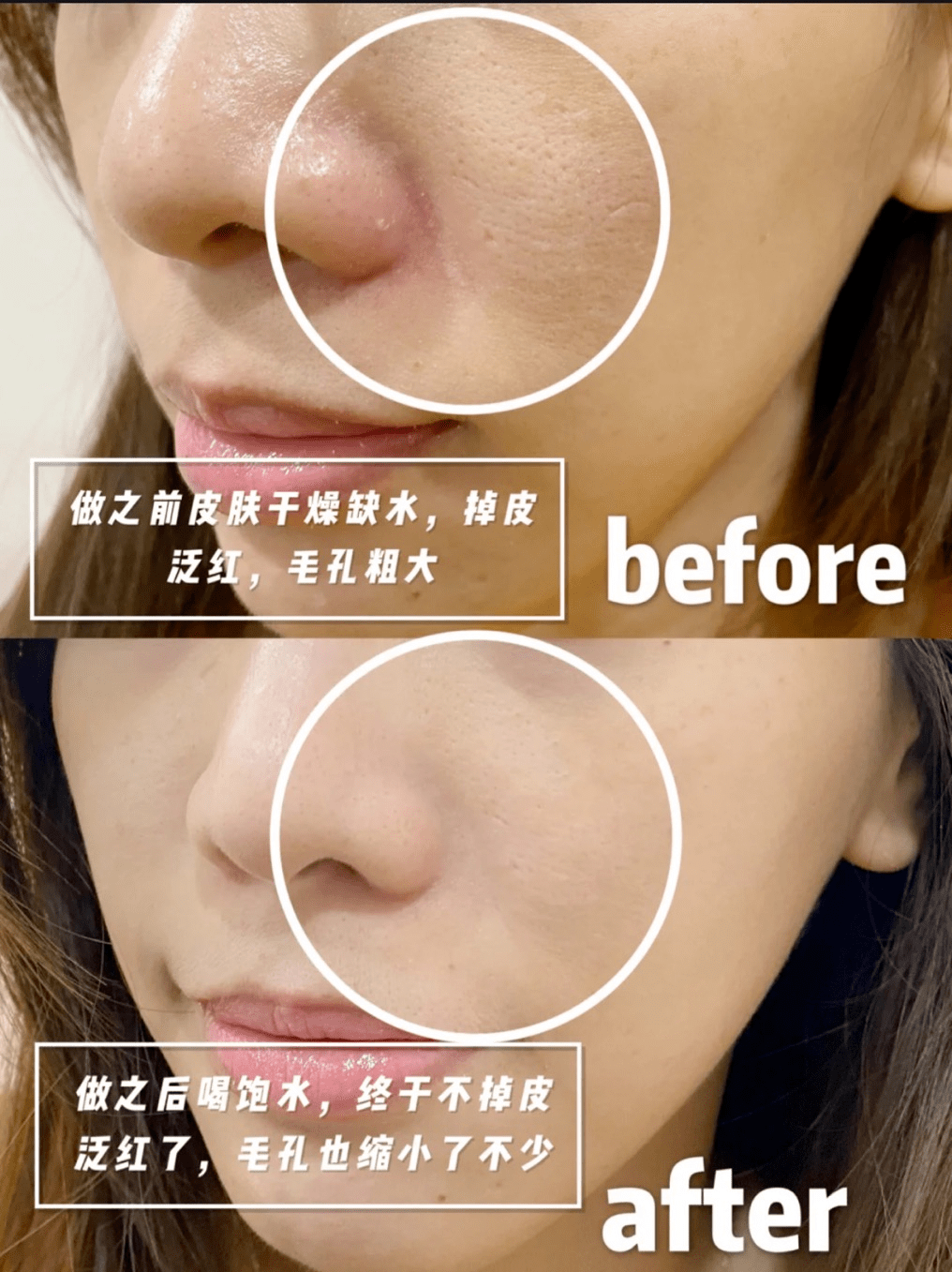 机器欧美明星罕见素颜照大盘点,最美竟是她?曝光美肤秘诀!