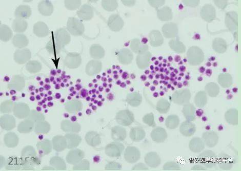 400x 未染色标本点击空白处查看答案白细胞血涂片 瑞氏