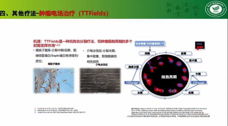 肿瘤|太阳穴双颞部疼痛，早晨和晚上症状较重，小心得脑肿瘤！