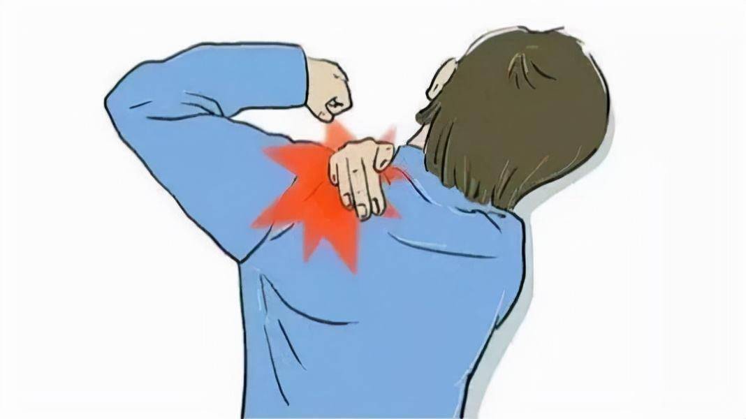 长期从事开关机工作57岁阿姨肩关节疼痛活动受限