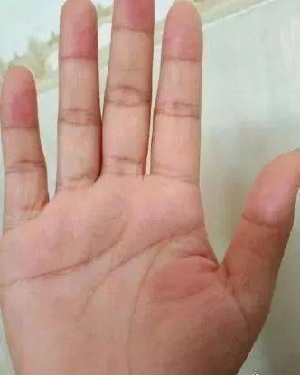 两指不碰头夫妻难白头一辈子注定多婚的手相之人