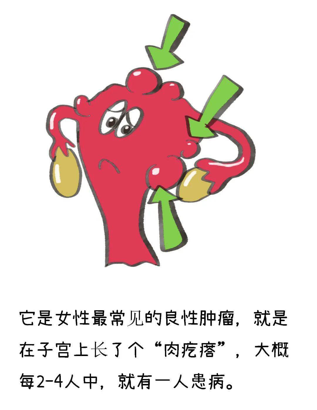 仁济科普 | 子宫肌瘤,"瘤"还是不留!_服务_附属_视频