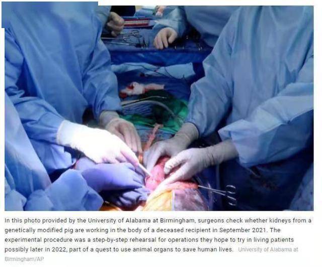 美国科学家又报告一猪器官移植实验，这次是给人移植猪肾