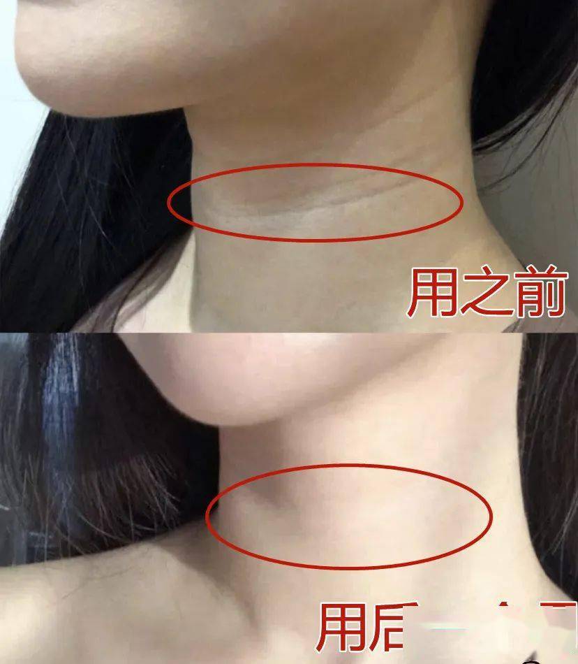 国货“显老”颈纹真的能“滚”掉!!430年的国货,一招get女明星“天鹅颈”!