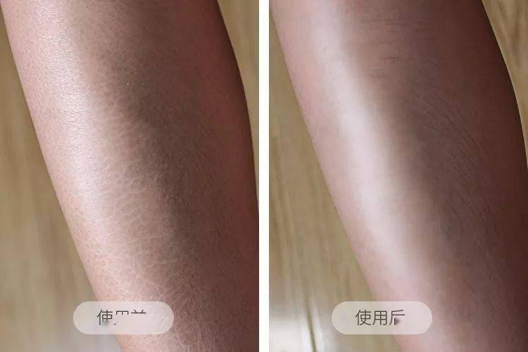 即使是她经常发干的腿部肌肤,使用后,鱼鳞般的干纹也消失了!