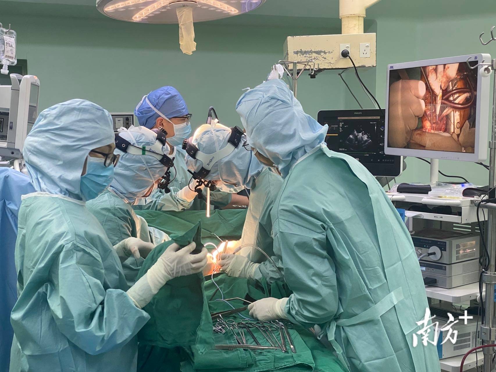 全球首例！中国医学团队成功实施“无缺血”心脏移植手术_凤凰网视频_凤凰网