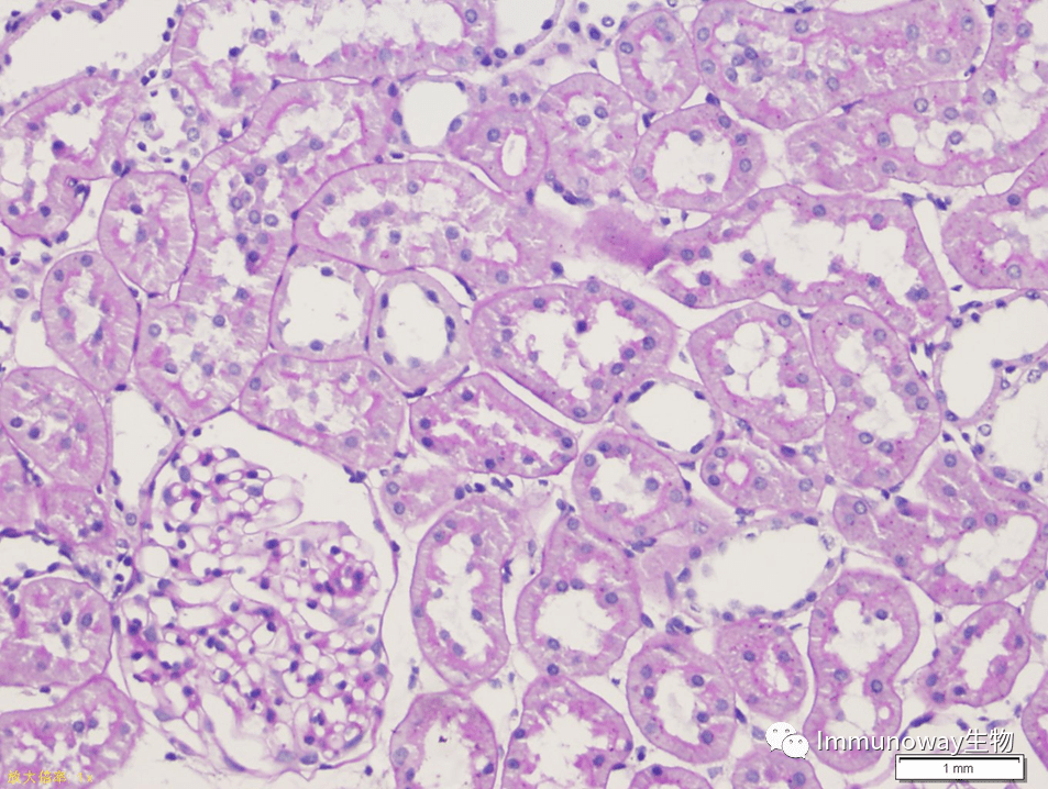 免疫组化(ihc)│常见问题及解析集锦_组织_染色_抗原