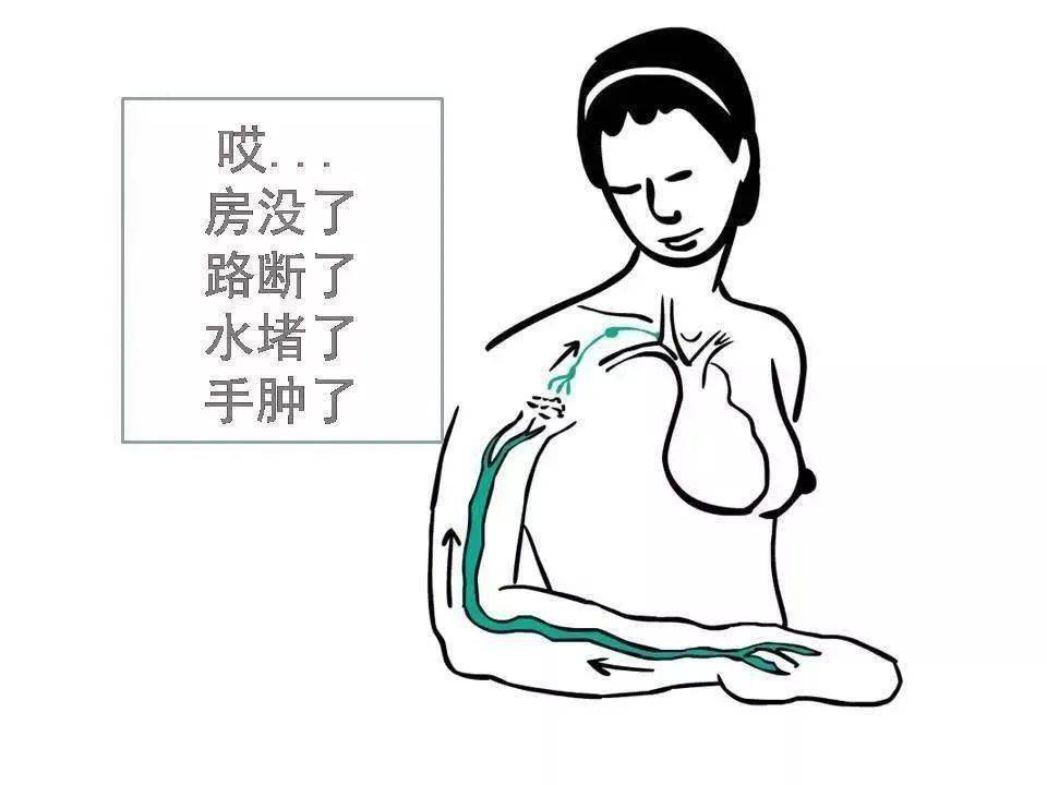 乳房的淋巴引流图片图片