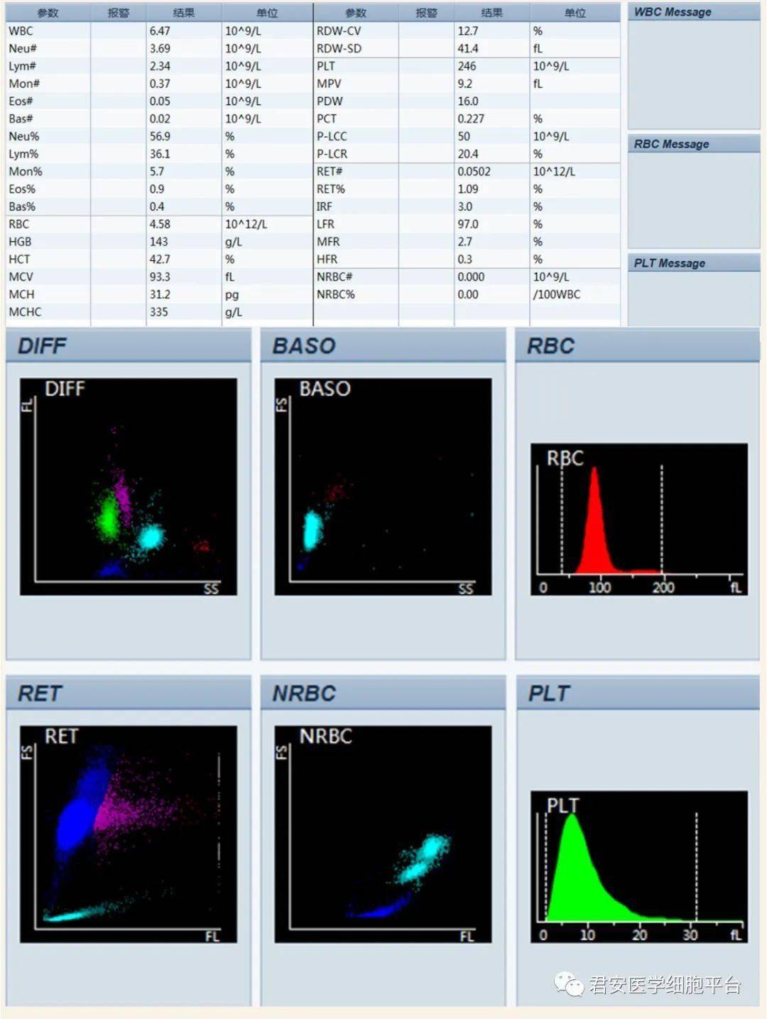 网织红细胞及临床应用