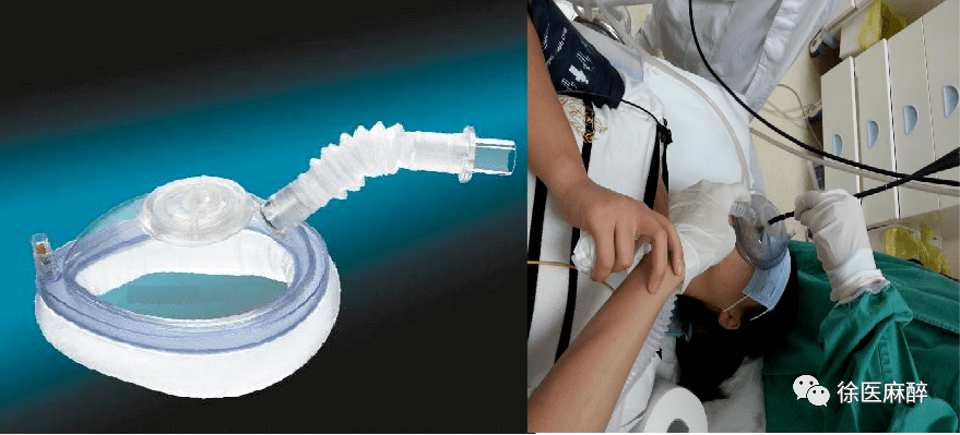 啥叫静脉麻醉 b0898233362a477fb94b25d6b61708b4.png