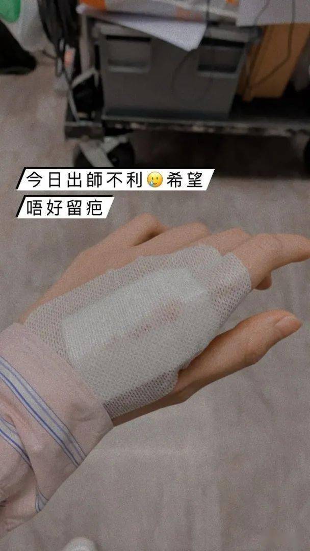 游嘉欣拍剧受伤 晒5cm长伤口吓窒网民_纱布_成只手_背有