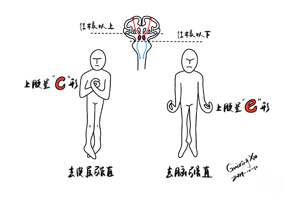 颈伸展反射向一侧旋转患者头部,出现面部所向一侧的上下肢强直性伸展