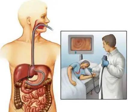 胃鏡檢查的全過程圖解