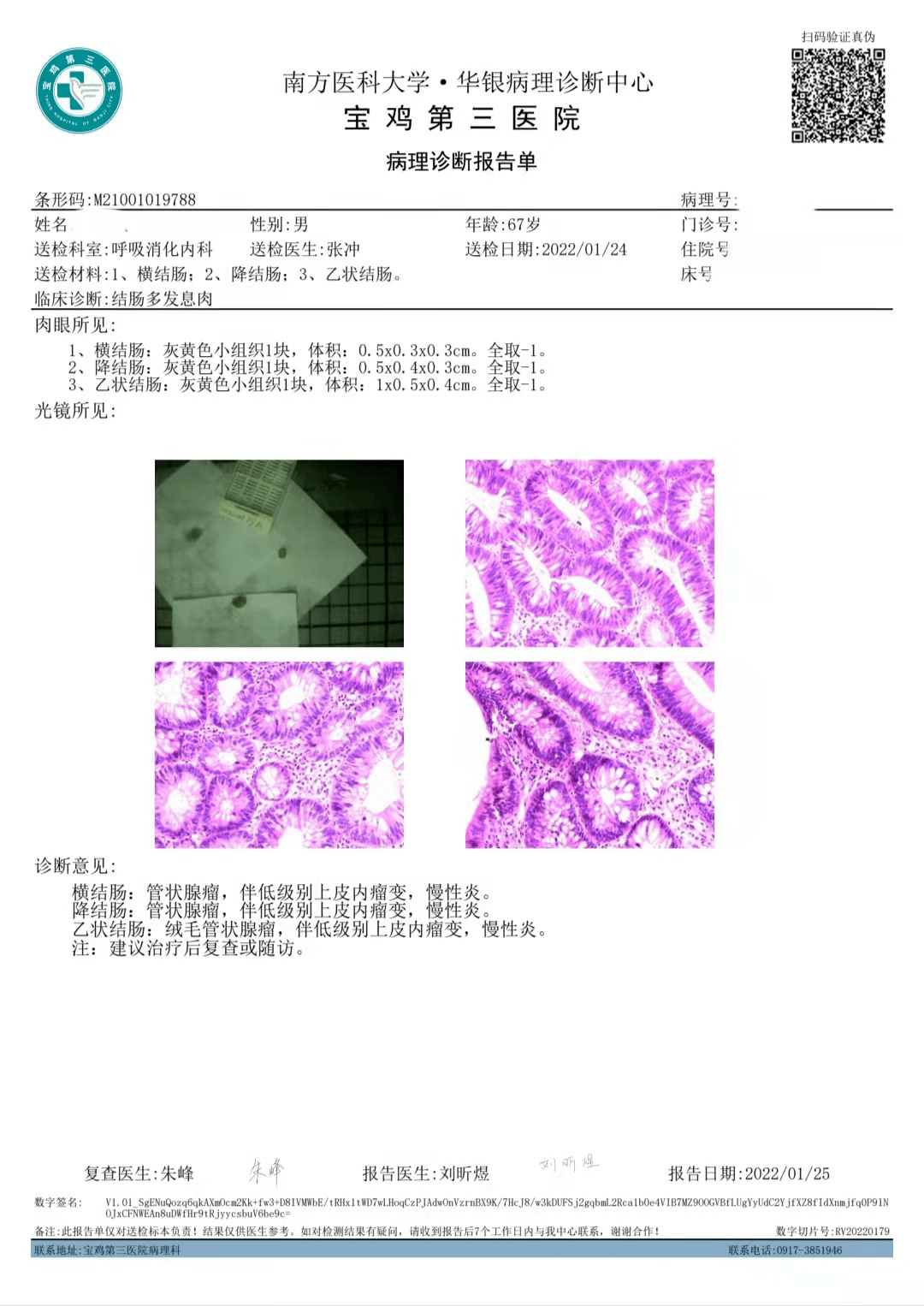 食管癌病理报告单图片图片
