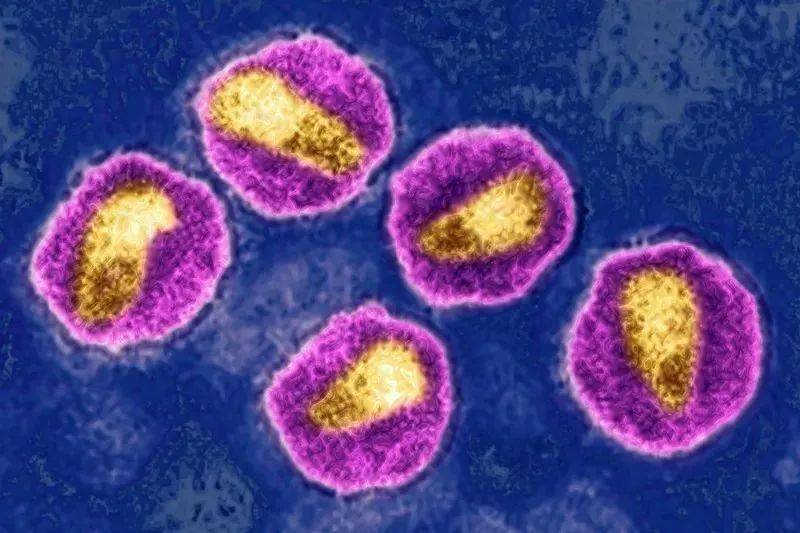 nature|高毒性HIV变异株已在欧洲存在数十年